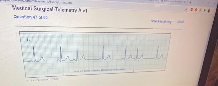 Medical surgical telemetry a relias