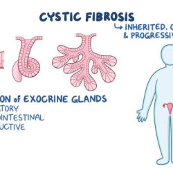 Nursing care cystic fibrosis edapt