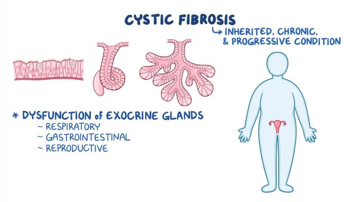 Nursing care cystic fibrosis edapt